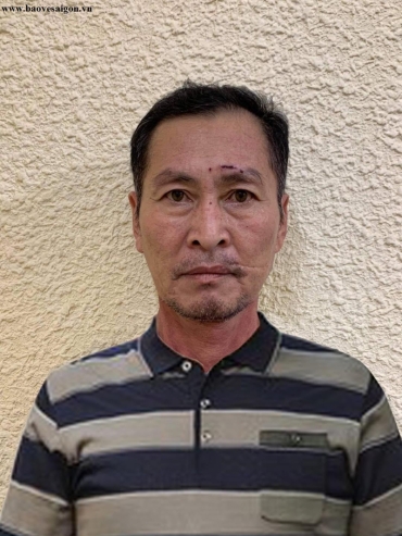 bao ve chung cu dam dong nghiep bi thuong