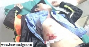 bao ve tram bot di dam trong thuong