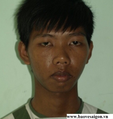 bao ve trom xe cua khach