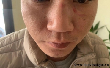 nhom bao ve danh cu dan nhap vien